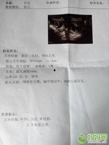 孕检单子图片,孕期健康监测全解析